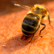 Drei Millionen Insektengift-Allergiker in der BRD
