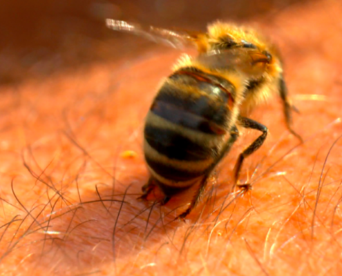 Drei Millionen Insektengift-Allergiker in der BRD